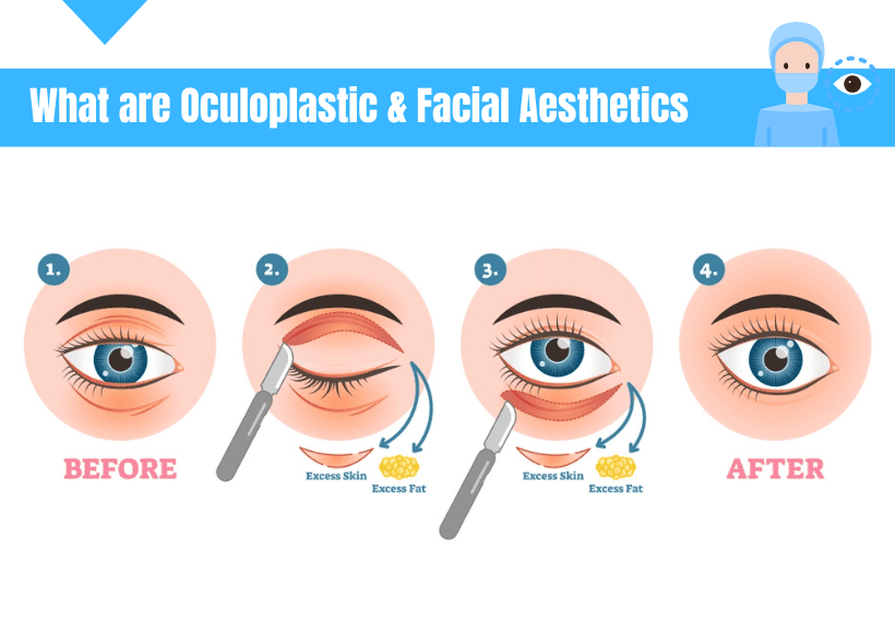 Oculoplastic