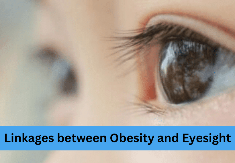 Obesity and Eyesight