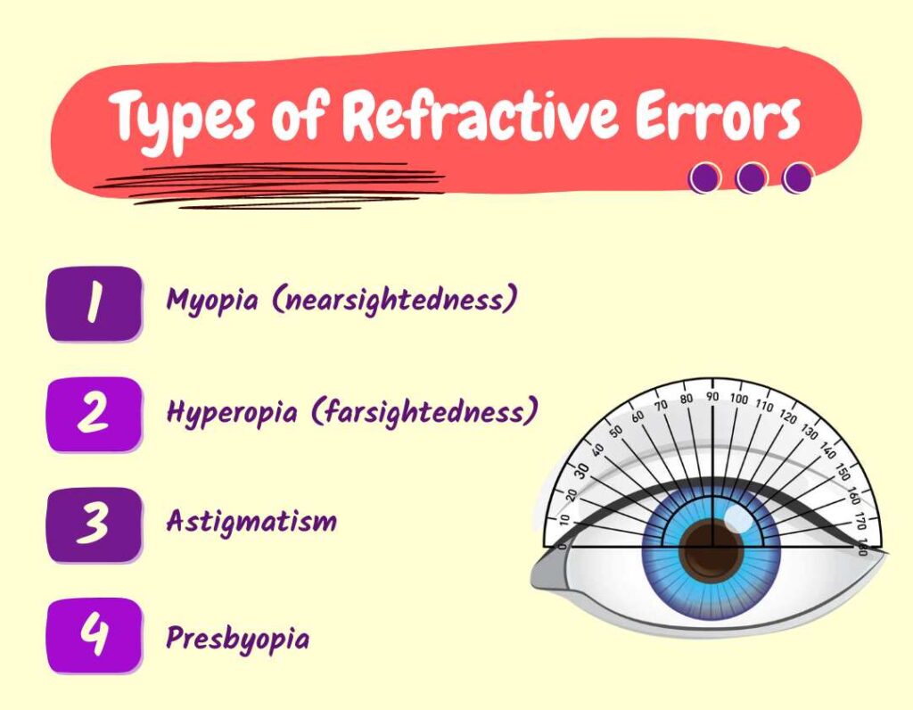 Types of Refractive Errors