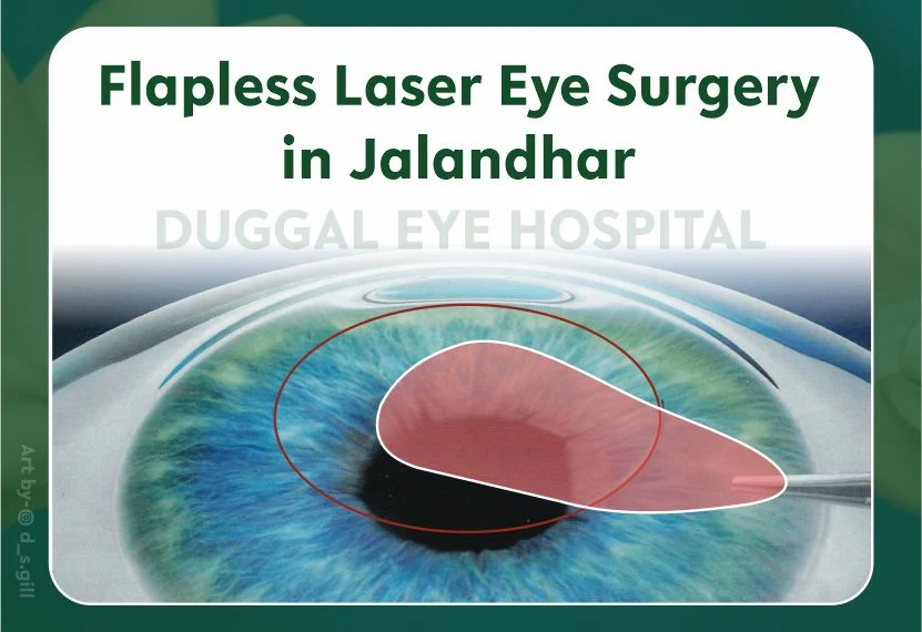 Flapless Laser Eye Surgery in Jalandhar