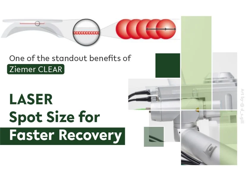Laser Spot size for Faster Recovery