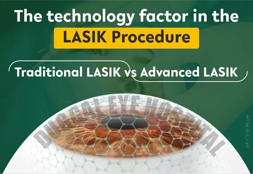 The technology factor in the LASIK Procedure