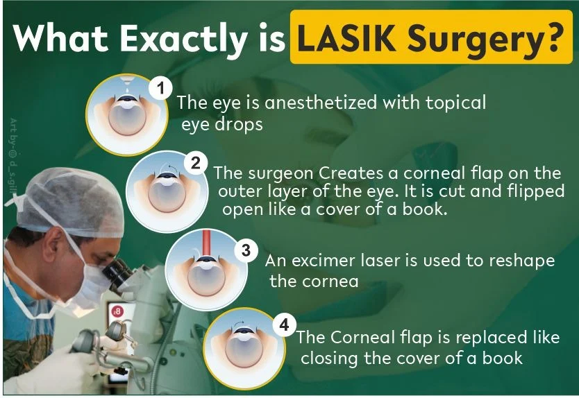 What Exactly is LASIK Surgery