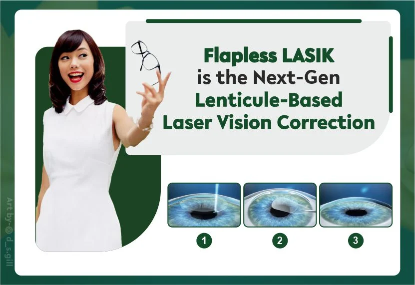 Flapless LASIK