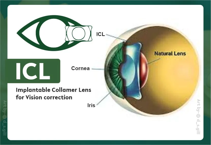 ICL Surgery